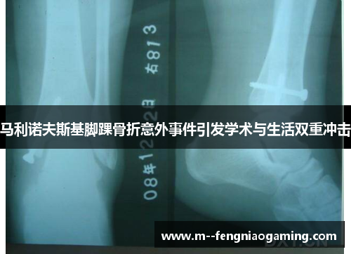 马利诺夫斯基脚踝骨折意外事件引发学术与生活双重冲击 马利诺夫斯基脚踝骨折意外事件引发学术与生活双重冲击